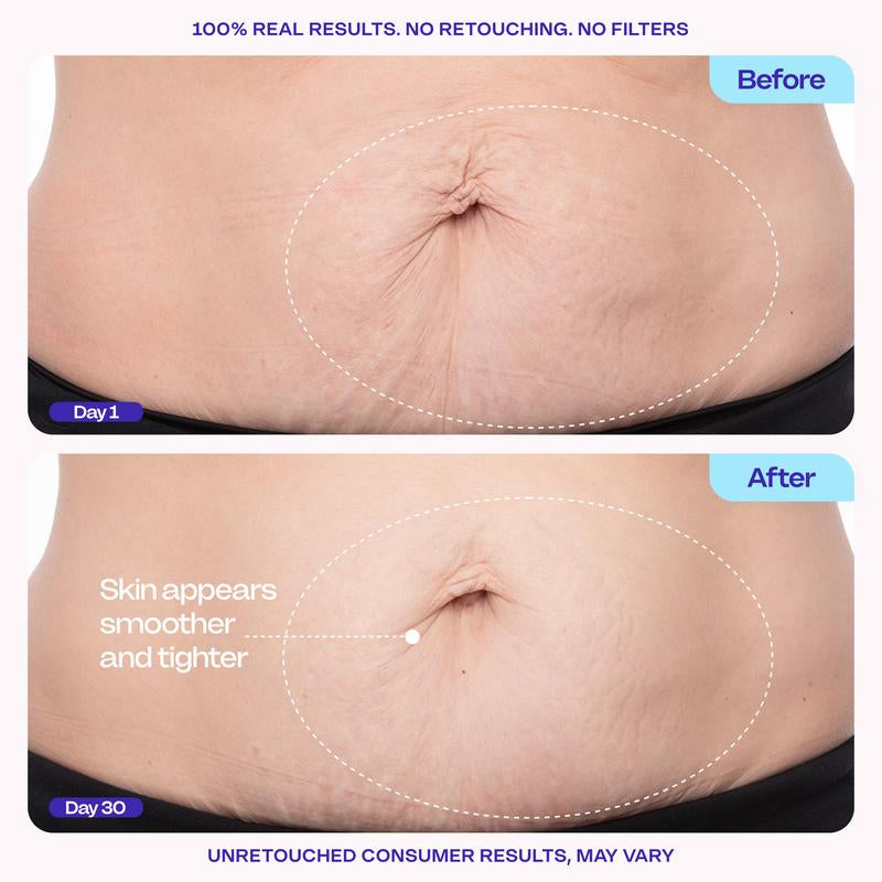 GOPURE Firming Cream for Tightening and Smoothing the Abdomen