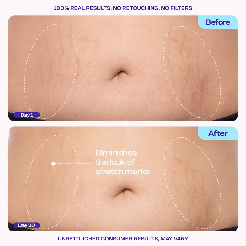 GOPURE Firming Cream for Tightening and Smoothing the Abdomen
